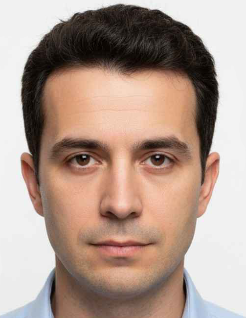 After — Hairline restoration · 2,800 grafts